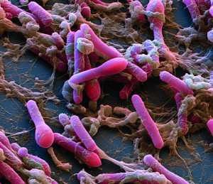 Clostridium botulinum bacteria. Coloured scanning electron micrograph (SEM) of Clostridium botulinum bacteria (rod-shaped), the cause of botulism in humans. Botulism is a type of food poisoning caused by the powerful neurotoxin that these bacteria produce. C. botulinum occurs naturally in soil, but can also flourish in badly-preserved canned meat. The neurotoxin poisons the central nervous system and can cause lethal heart or lung failure. It is destroyed by thorough cooking, but the bacterial cells can survive heat in the form of spores. Magnification: x8000 when printed 10 centimetres wide.